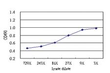 Anti-ZSCAN20 Antibody Pair