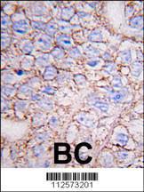 Anti-MAP Kinase 15 Rabbit Polyclonal Antibody