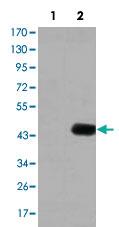 Anti-CEACAM5 Mouse Monoclonal Antibody [clone: 1C7]