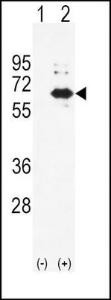 Anti-ALPL Rabbit Polyclonal Antibody