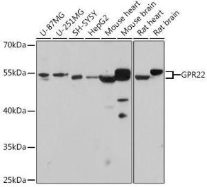 Western blot analysis of extracts of various cell lines, using Anti-GPCR GPR22 Antibody (A307102) at 1:1,000 dilution. The secondary antibody was Goat Anti-Rabbit IgG H&L Antibody (HRP) at 1:10,000 dilution.