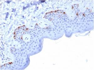 Immunohistochemical analysis of formalin-fixed, paraffin-embedded human skin using Anti-Melanoma gp100 Antibody [PMEL/2037]