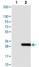 Anti-C1orf123 Rabbit Polyclonal Antibody