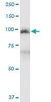 Anti-MCC Polyclonal Antibody Pair