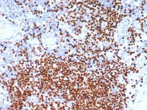 Immunohistochemical analysis of formalin-fixed, paraffin-embedded human lymph node tissue using Anti-SOX11 Antibody [SOX11/7236]