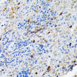 Immunohistochemistry analysis of paraffin-embedded rat spleen using Anti-Carma 1/CARD11 Antibody [ARC1680] (A305673) at a dilution of 1:100 (40X lens). Perform microwave antigen retrieval with 10 mM Tris/EDTA buffer pH 9.0 before commencing with IHC staining protocol