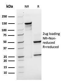 SDS-PAGE analysis of Anti-SOX2 Antibody [rSOX2/1791] under non-reduced and reduced conditions; showing intact IgG and intact heavy and light chains, respectively. SDS-PAGE analysis confirms the integrity and purity of the antibody.