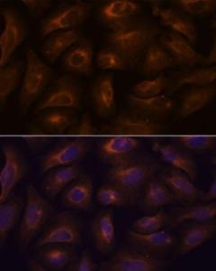 Immunofluorescence analysis of U-2 OS cells using Anti-GPCR GPR22 Antibody (A307102) at a dilution of 1:100. DAPI was used to stain the cell nuclei (blue).