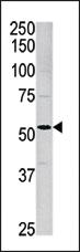 Anti-ACVR1 Rabbit Polyclonal Antibody