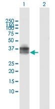 Anti-CD207 Rabbit Polyclonal Antibody