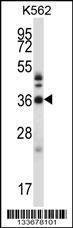 Anti-CRKL Rabbit Polyclonal Antibody (Biotin)