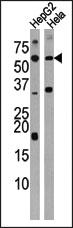 Anti-ACVR1C Rabbit Polyclonal Antibody