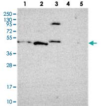 Anti-FBRS Rabbit Polyclonal Antibody