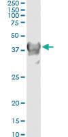 Anti-CRYM Antibody Pair