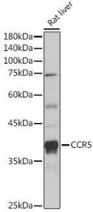 Western blot analysis of extracts of Rat liver, using Anti-CCR5 Antibody (A307104) at 1:1,000 dilution. The secondary antibody was Goat Anti-Rabbit IgG H&L Antibody (HRP) at 1:10,000 dilution.