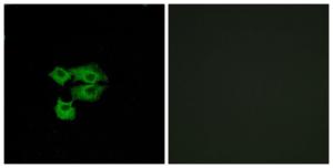 Immunofluorescence analysis of A549 cells using Anti-LY6E Antibody. The right hand panel represents a negative control, where the antibody was pre-incubated with the immunising peptide