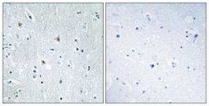 Anti-SOX12 antibody