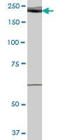 Anti-WHSC1L1 Mouse Polyclonal Antibody