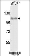 Anti-HSPH1 Rabbit Polyclonal Antibody