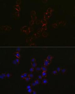 Immunofluorescence analysis of Jurkat cells using Anti-CCR5 Antibody (A307104) at a dilution of 1:50 (40x lens). DAPI was used to stain the cell nuclei (blue).