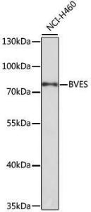 Western blot analysis of extracts of NCI-H460 cells, using Anti-BVES Antibody (A12545) at 1:1,000 dilution. The secondary antibody was Goat Anti-Rabbit IgG H&L Antibody (HRP) at 1:10,000 dilution.