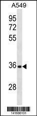 Anti-CD5L Rabbit Polyclonal Antibody (Biotin)