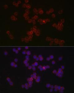 Immunofluorescence analysis of THP-1 cells using Anti-CCR5 Antibody (A307104) at a dilution of 1:50 (40x lens). DAPI was used to stain the cell nuclei (blue).