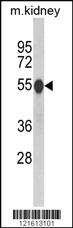 Anti-CAT Rabbit Polyclonal Antibody