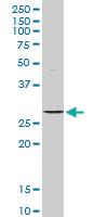 Anti-STK16 Rabbit Polyclonal Antibody