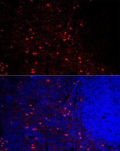 Immunofluorescence analysis of mouse spleen cells using Anti-CCR5 Antibody (A307104) at a dilution of 1:100 (40x lens). DAPI was used to stain the cell nuclei (blue).