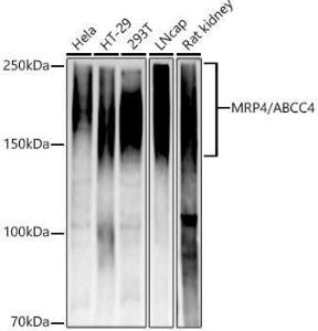 Western blot analysis of various lysates, using Anti-MRP4 Antibody [ARC52223] (A309684) at 1:1000 dilution. The secondary Antibody was Goat Anti-Rabbit IgG H&L Antibody (HRP) at 1:10000 dilution. Lysates/proteins were present at 25 µg per lane