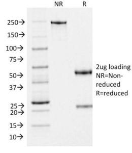 SDS-PAGE analysis of Anti-Melanoma gp100 Antibody [PMEL/2037] under non-reduced and reduced conditions; showing intact IgG and intact heavy and light chains, respectively. SDS-PAGE analysis confirms the integrity and purity of the antibody