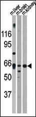 Anti-ACVR2A Rabbit Polyclonal Antibody