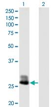 Anti-CFHR2 Mouse Polyclonal Antibody