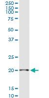 Anti-SAP18 Rabbit Polyclonal Antibody