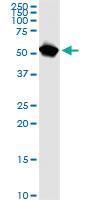 Anti-NUP62 Mouse Monoclonal Antibody [clone: 2D3]