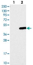 Anti-YIPF3 Rabbit Polyclonal Antibody