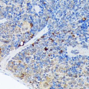 Immunohistochemistry analysis of paraffin-embedded mouse spleen using Anti-Carma 1/CARD11 Antibody [ARC1680] (A305673) at a dilution of 1:100 (40X lens). Perform microwave antigen retrieval with 10 mM Tris/EDTA buffer pH 9.0 before commencing with IHC staining protocol