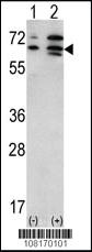 Anti-SETD8 Mouse Monoclonal Antibody