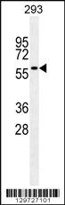 Anti-CCDC36 Rabbit Polyclonal Antibody