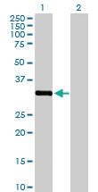 Anti-STK16 Rabbit Polyclonal Antibody