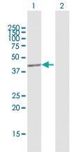 Anti-CHKB Rabbit Polyclonal Antibody