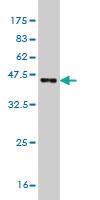 Anti-TSSC1 Mouse Monoclonal Antibody [clone: 2H5]