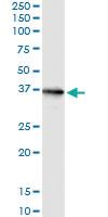 Anti-CRYM Polyclonal Antibody Pair