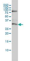 Anti-STK16 Mouse Monoclonal Antibody [clone: M2]