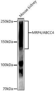 Western blot analysis of Mouse kidney, using Anti-MRP4 Antibody [ARC52223] (A309684) at 1:1000 dilution. The secondary Antibody was Goat Anti-Rabbit IgG H&L Antibody (HRP) at 1:10000 dilution. Lysates/proteins were present at 25 µg per lane