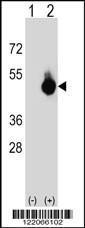 Anti-HLA-B-associated Transcript 4 Rabbit Polyclonal Antibody (AP (Alkaline Phosphatase))