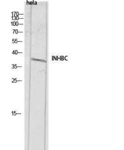 Antibody anti-INHBC 100 µg