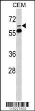 Anti-FKBP10 Rabbit polyclonal antibody