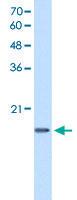 Anti-DUT Rabbit Polyclonal Antibody